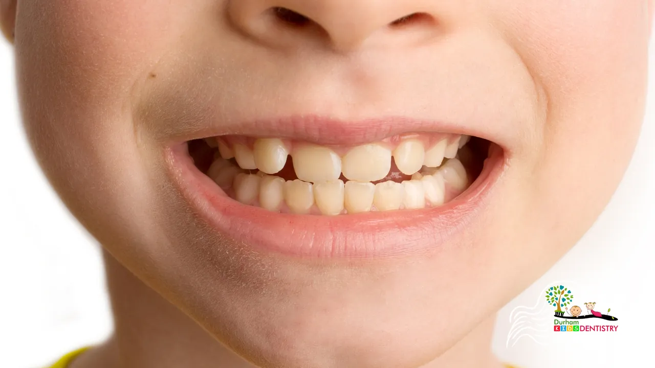 A close up of a child 's mouth showing his teeth.